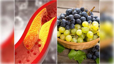 5 Fruits To Reduce Bad Cholesterol