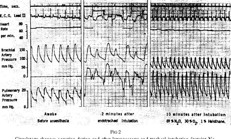 Methohexital | Semantic Scholar