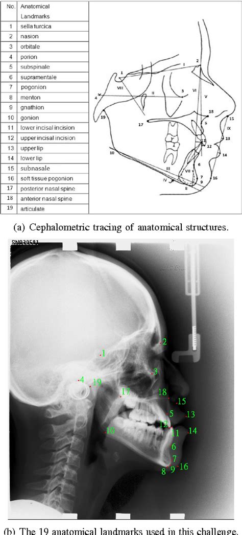 Figure 1 From Evaluation And Comparison Of Anatomical Landmark