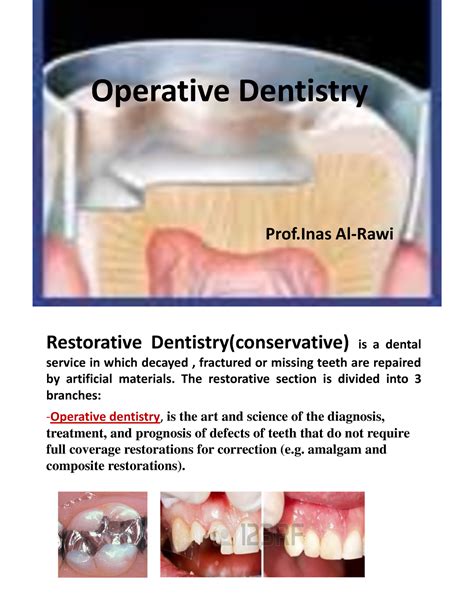 Operative Dentistry Introduction Operative Dentistry Prof Al Rawi