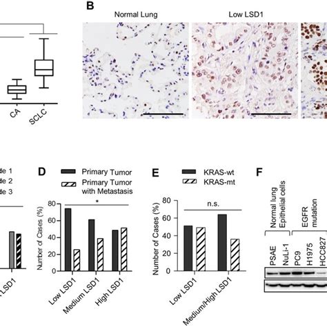 Overexpression Of Lsd1 In High Grade And Metastasized Lung