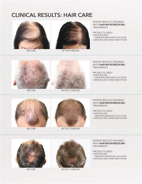 How to Boost Healthy Hair Growth - Restore Integrative Medical Clinic