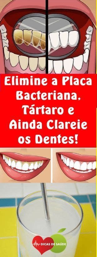 Maneiras Naturais De Remover A Placa Bacteriana Dicas Gr Tis Mund