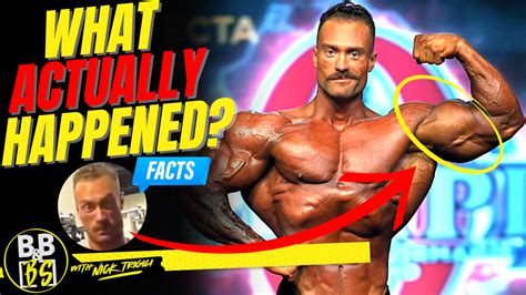 Chris Bumstead Deformed Bicep At The Mrolympia Finally Explained