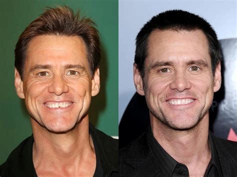 🦷Clip-On Veneers: Are They Worth It? | LEMA