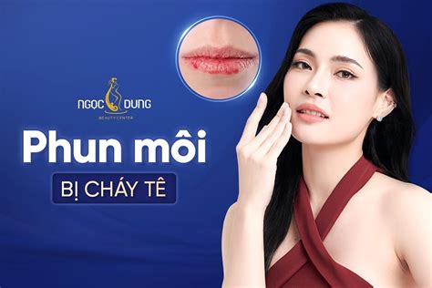 Phun môi bị cháy tê là gì? Phải làm sao và cách khắc phục hiệu quả