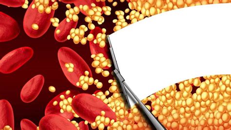 The Truth About Blood Thinners