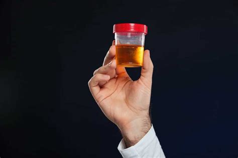 Ematuria Ovvero Sangue Nelle Urine Valdo Vaccaro