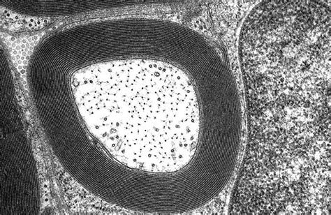 HLS [ Ultrastructure of the Cell, Myelinated Axon] HIGH MAG