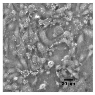 Image comparison during Plasmocin treatment. This series of images ...