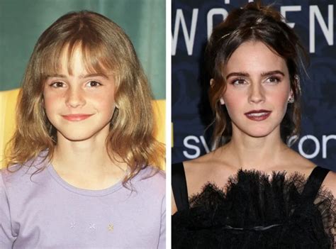 Photos Emma Watson A 31 Ans Retour Sur Son évolution Physique Public