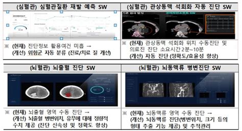 토종 Ai 정밀의료 서비스 ‘닥터 앤서 임상 적용 시작