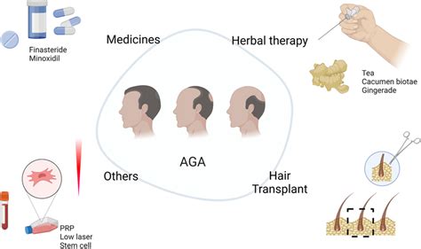 Traditional therapies for androgenetic alopecia | Download Scientific ...