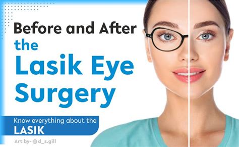 Before and After Lasik Eye Surgery – Know everything about the LASIK ...