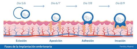 S Ntomas De La Implantaci N Embrionaria
