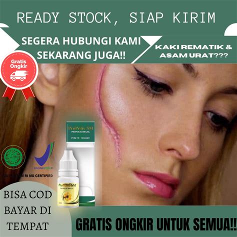 Jual Obat Bekas Luka Di Wajah Bekas Luka Koreng Hitam Di Kaki Bekas