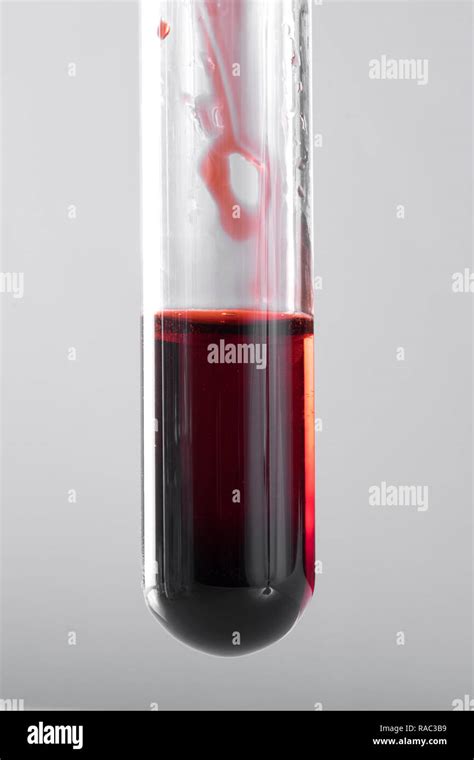 Blood test tube Stock Photo - Alamy