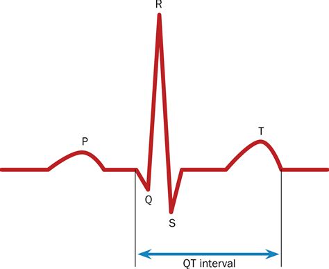 Mechanisms And Management Of Druginduced Qt Prolongation Parsons