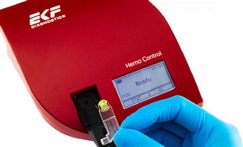 Hemo Control Ekf Hemoglobin Hematocrit Reader Skroollmed