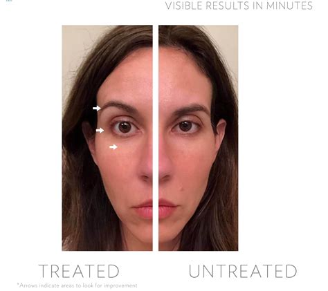 Lumispa™ Accent Y Idealeyes De Ageloc® Renuevathe