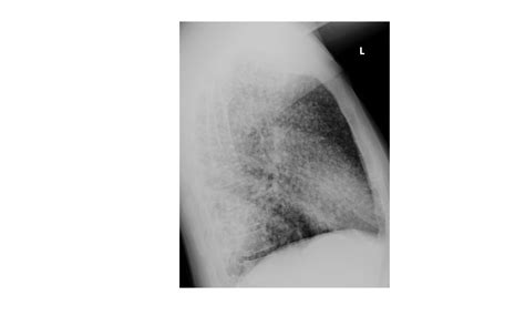 imaging case   week  emergucate