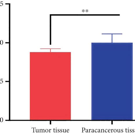 A Relative Expression Of Mir A P In Hcc And Normal Liver Cell