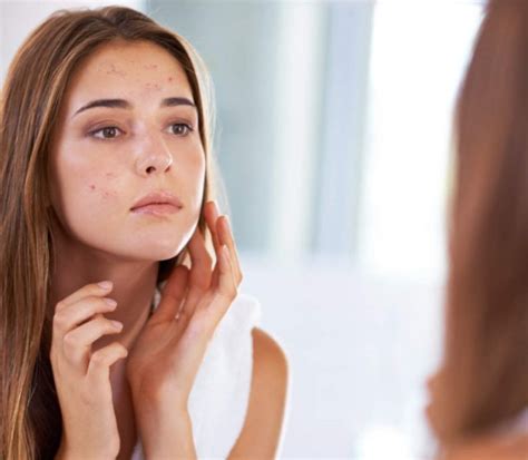 A Comprehensive Guide To Acne Scar Removal Options And Outcomes