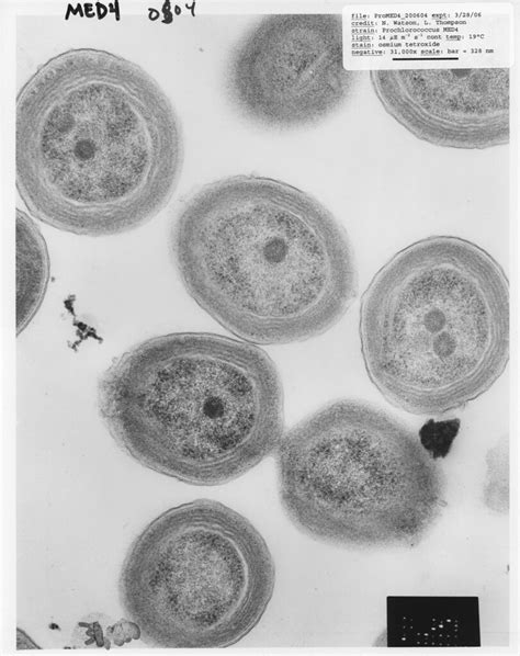 Prochlorococcus MED4 | TEM of Prochlorococcus MED4. Taken by… | Flickr