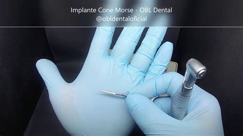 Instalação Implante Cone Morse OBL Dental YouTube