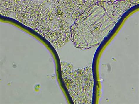 Microscopia De Lodos Ativados 6 YouTube