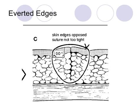 Fwd Wound Healing