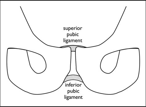 Figure 5 From Postpartum Symphysis Pubis Diastasis Semantic Scholar