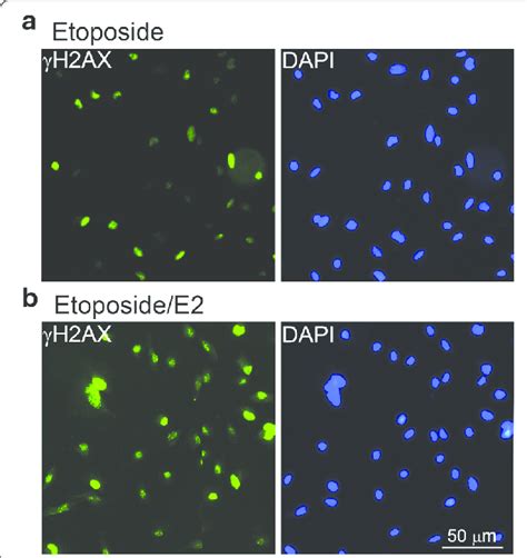 Dna Repairing Ability Of A Cells With Treatments Of Etoposide And