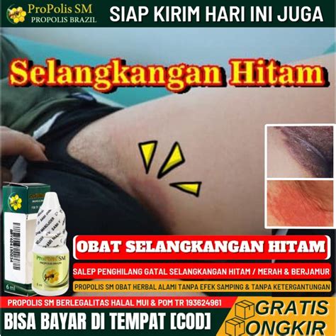 Jual Salep Penghilang Selangkangan Gatal And Berwarna Hitam 100 Alami