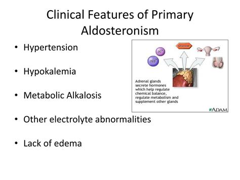 PPT - Aldosteronism PowerPoint Presentation, free download - ID:4760704