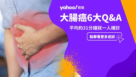 大腸癌症狀有什麼？「台灣癌症發生率榜首」常放屁要注意！大腸癌篩檢哪些人可以免費做？ Yahoo奇摩汽車機車