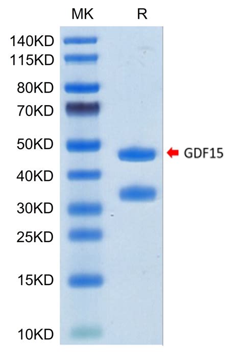 Biotinylated Human Gdf Protein Primary Amine Labeling Gdf Hm B