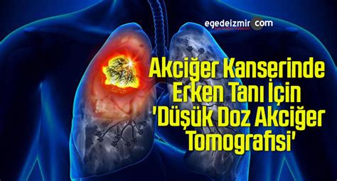 Akciğer Kanserinde Erken Tanı İçin Düşük Doz Akciğer Tomografisi Ege