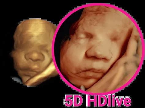 D Ultrasound Hdlive D Baby Boutique Michigan