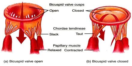 Tricuspid Valve - Assignment Point