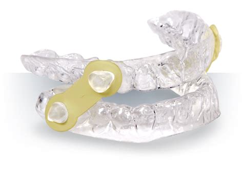 Oral Appliance Therapy Buffalo Ny Buffalo Tmj