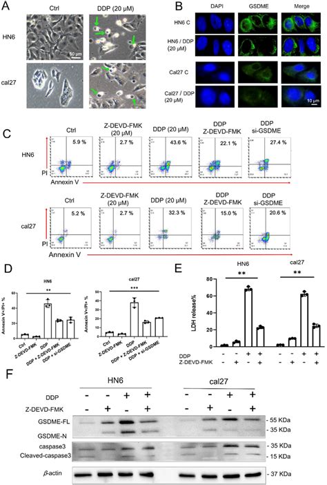 Cisplatin Induce Pyroptosis In OSCC Cell Lines Through Caspase3 GSDME