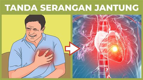 Waspada Serangan Jantung Rasa Dan Pengalaman Selamat Dari Penyakit