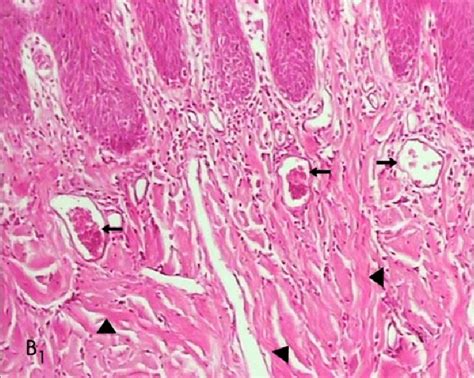 A Histologic Photomicrograph Of Hematoxylin And Eosin Stained Sections