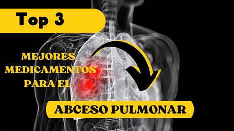 Descubre Los Mejores Medicamentos Para El Absceso Pulmonar Youtube