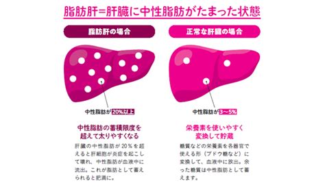 どうして脂肪肝を改善することがダイエットにつながるのか？【1週間で勝手に痩せていく体になるすごい方法】 ラブすぽ