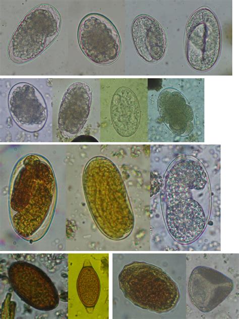 Various types of eggs of Strongyle parasite (9400). a, b Blastomeres ...