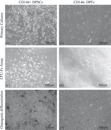 Morphology Of Cells Within Cultures A Typical Fusiform Fibroblast