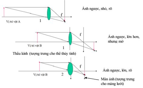 Câu 1 Mô Tả Cấu Tạo Của Mắt Nói Chung Và Màng Lưới Nói Riêng Olm