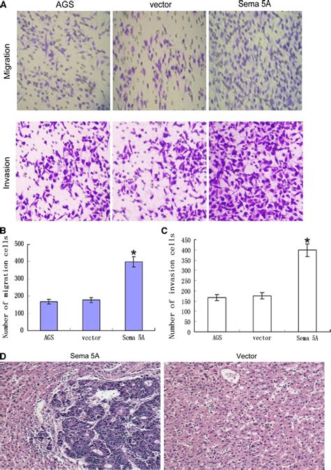 Effects Of Semaphorin A Overexpression On The Migration Invasion And